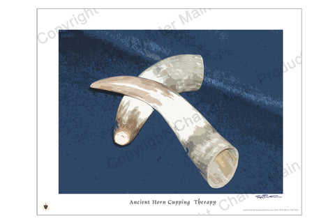 Poster-Two Ancient Horn Cupping Devices-history-evolution-cupping therapy